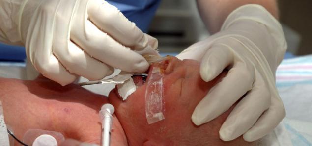 A nurse intubates a newborn.