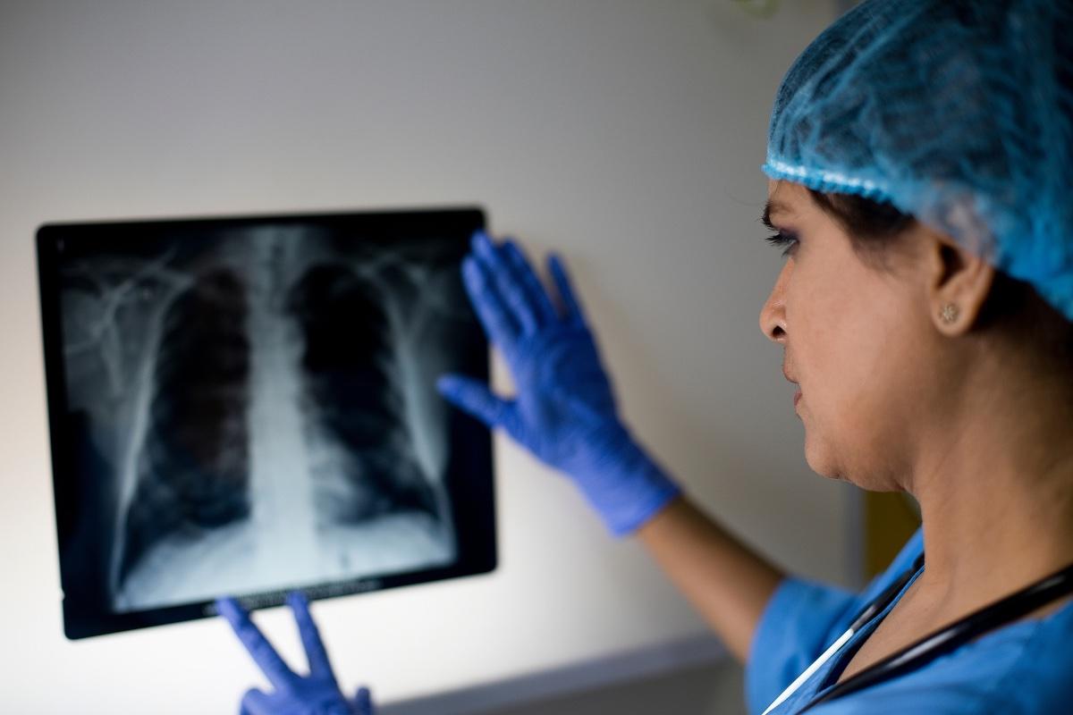 Health care provider reviews a chest x-ray