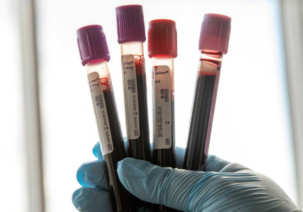 Hand holding vials of blood