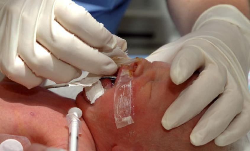 A nurse intubates a newborn.