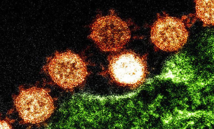 An image of the novel coronavirus