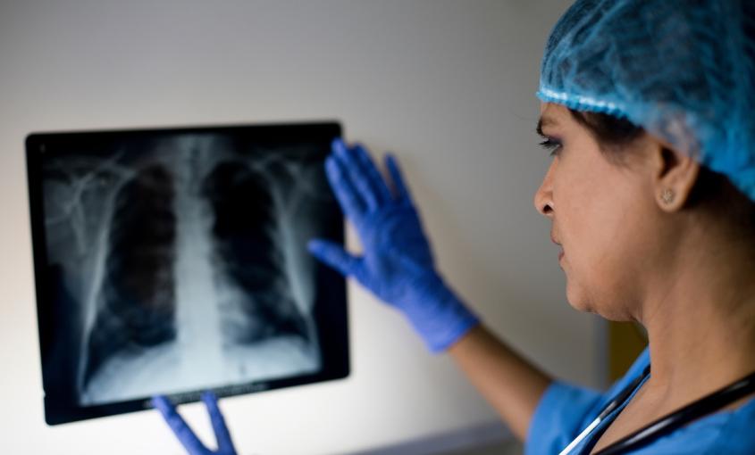 Health care provider reviews a chest x-ray