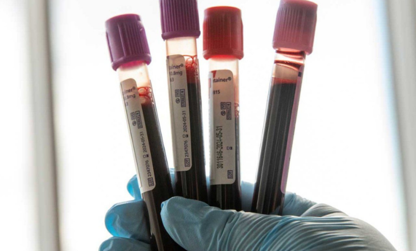 Hand holding vials of blood